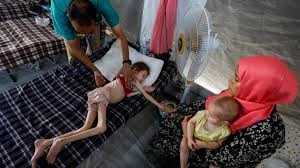 Children at Risk Famine in Gaza
