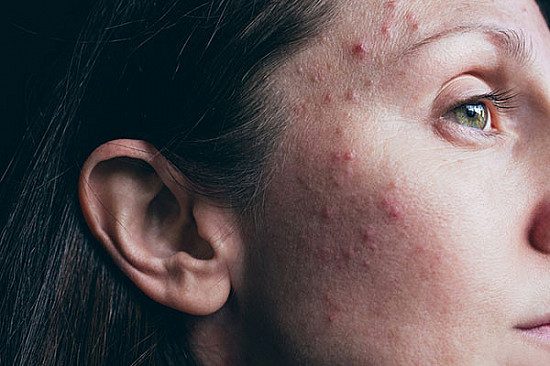 summer skin problems