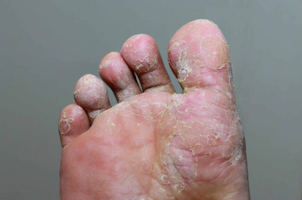 summer skin problems
