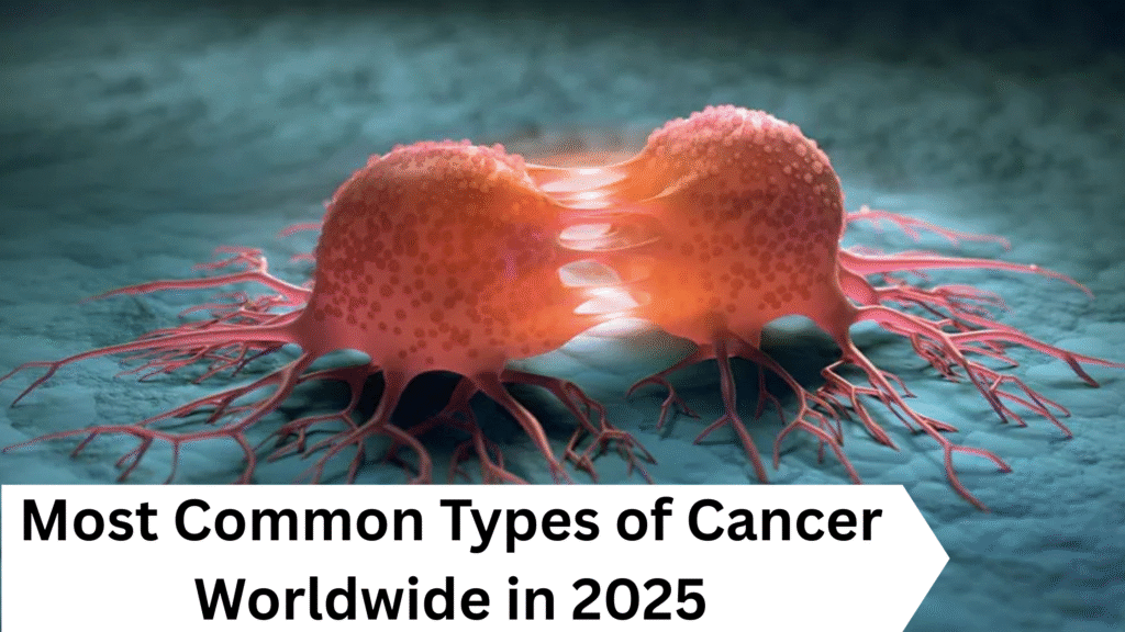 Types of Cancer Worldwide in 2025