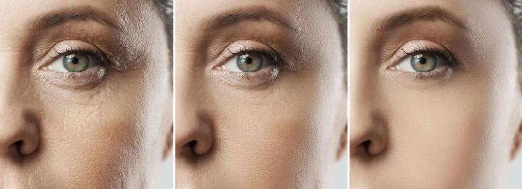 Wrinkle Free Skin