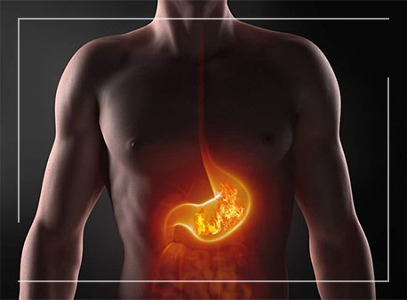 What Is Heartburn