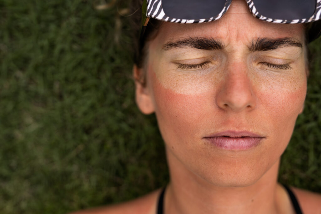 summer skin problems
