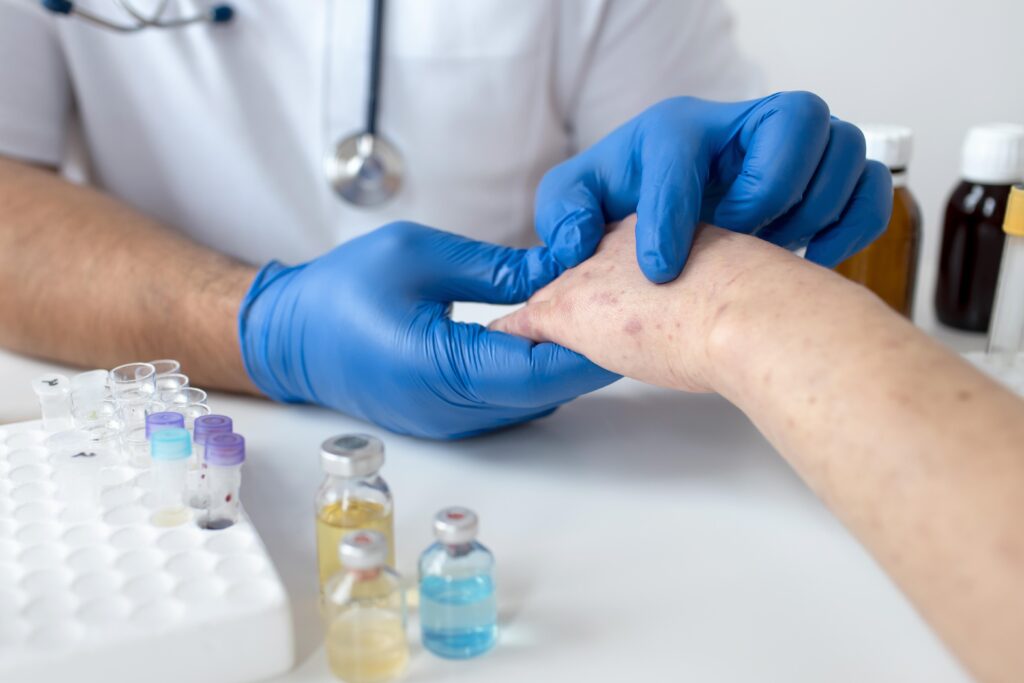 bacterial skin infection treatments