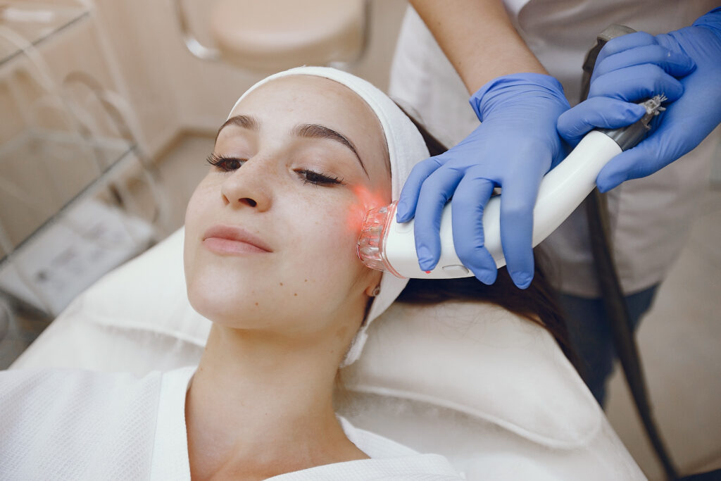 Laser Treatment for Rosacea