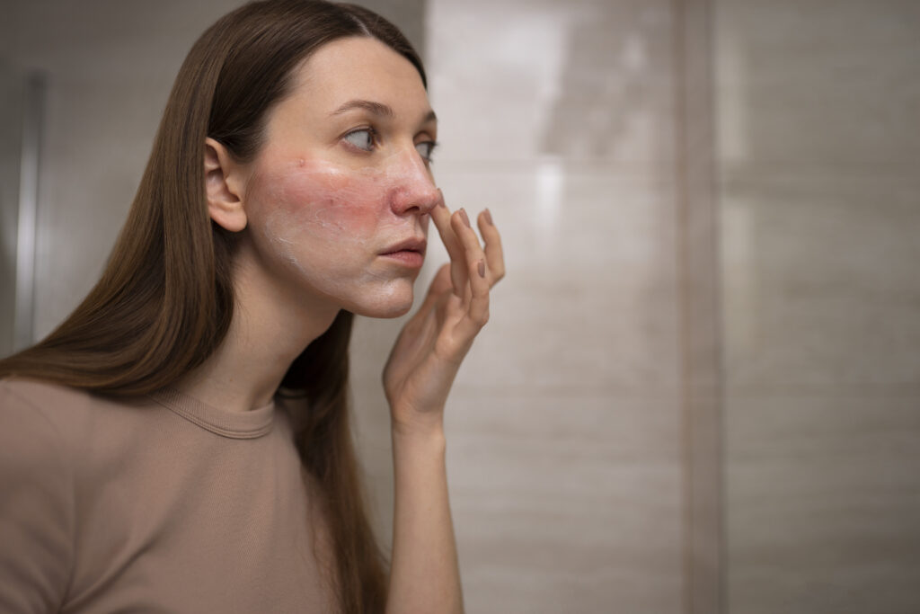 Monsoon Skin Infections