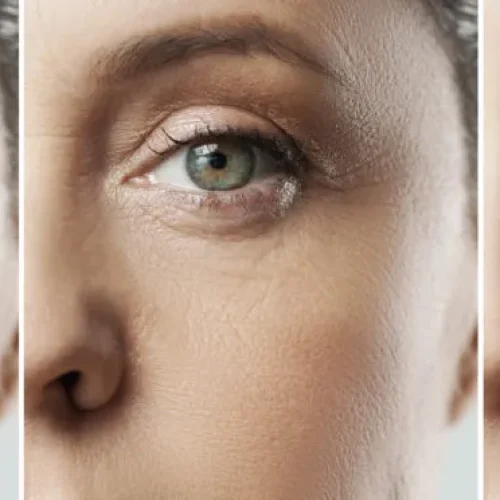 Wrinkle Free Skin