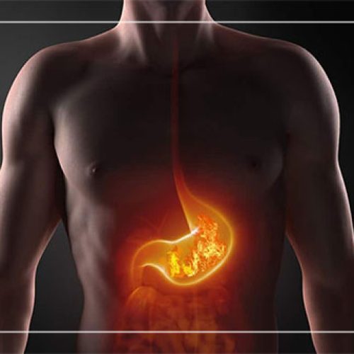 What Is Heartburn